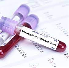 Phosphate Blood Test