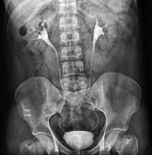 full body X-rays