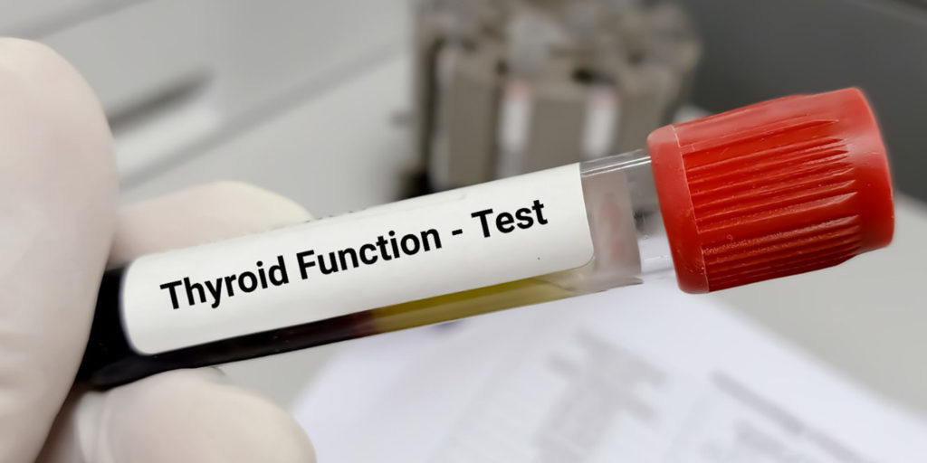 Understanding Thyroid Function Tests