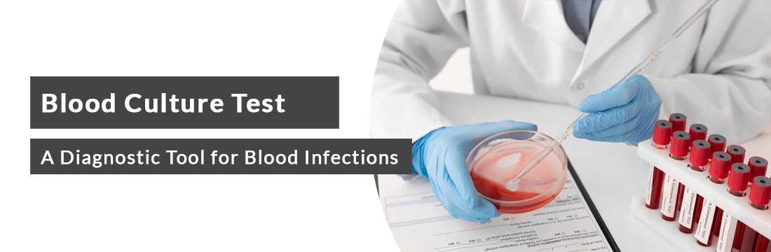 blood culture test