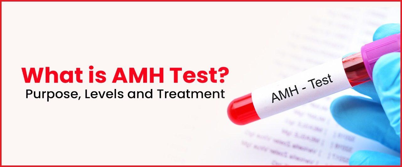 AMH Test