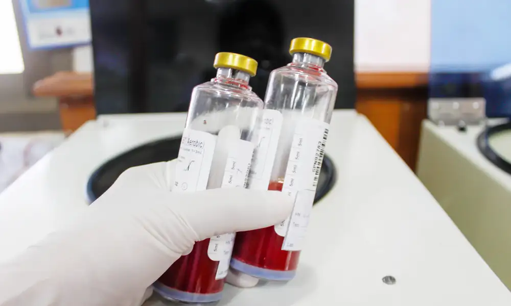 blood test