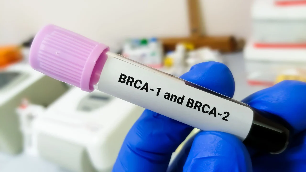 brca testing
