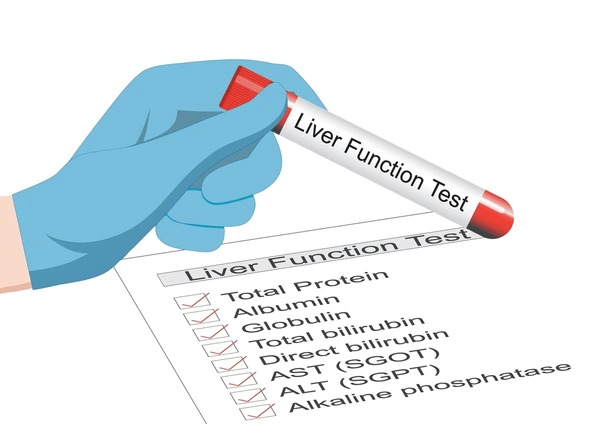 liver-function-tests